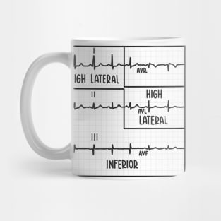 Hand Drawn 12 Lead Electrocardiogram (ECG) Black Mug